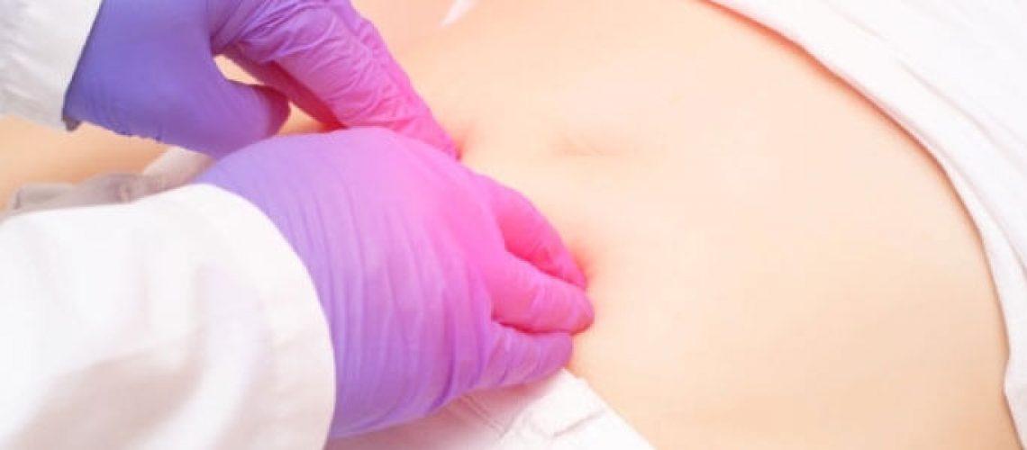 faja para hernia inguinal